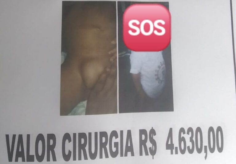 IBICARAÍ: CRIANÇA SOFRE SEM FAZER CIRURGIA DE HÉRNIA